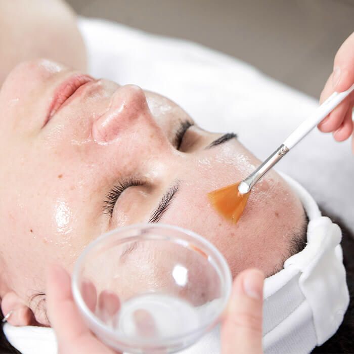 Chemical peel